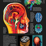 The Human Brain Book: An Illustrated Guide to its Structure, Function, and Disorders2019
