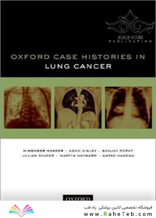 Oxford Case Histories in Lung Cancer2019  سرطان ریه