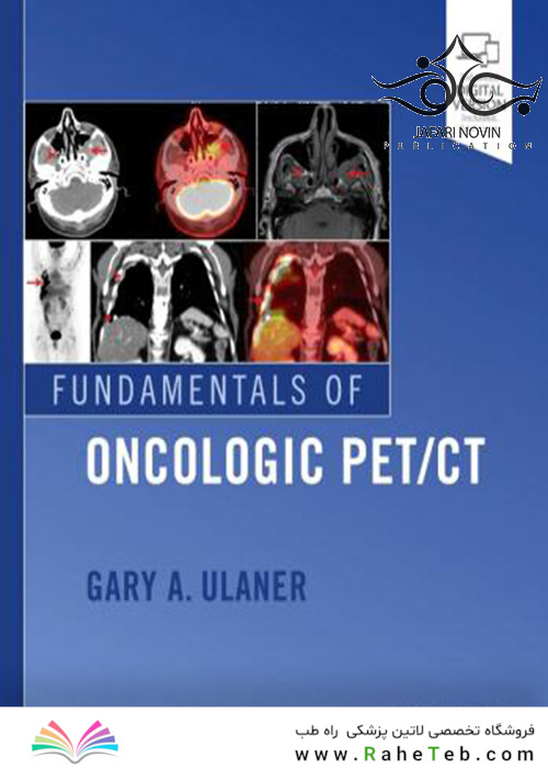 Fundamentals of Oncologic Pet/CT 1st Edition2018 مبانی آنکولوژیک حیوان خانگی سی تی