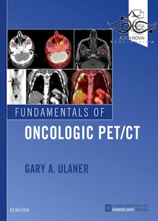 عکس Fundamentals of Oncologic Pet/CT 1st Edition2018 مبانی آنکولوژیک حیوان خانگی سی تی