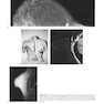 Breast Imaging (Kopans, Breast Imaging) Third Edition2006