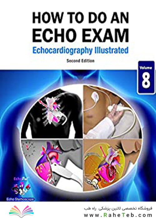 How To Do An Echo Exam: Second Edition (Echocardiography Illustrated) Second Edition