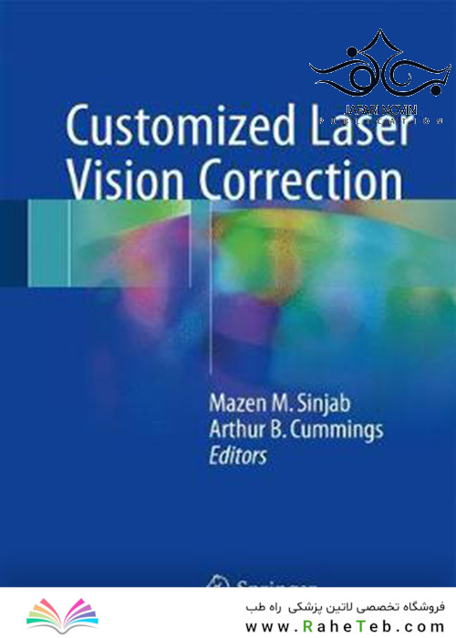 Customized Laser Vision Correction2018 تصحیح بینایی لیزری