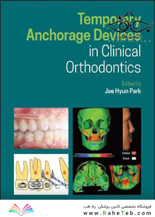 Temporary Anchorage Devices in Clinical Orthodontics