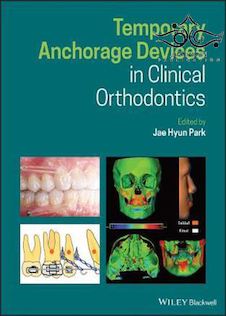 عکس Temporary Anchorage Devices in Clinical Orthodontics