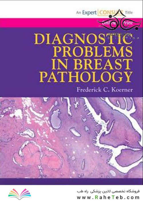 Diagnostic Problems in Breast Pathology 1st Edition2008 مشکلات تشخیصی در آسیب شناسی پستان