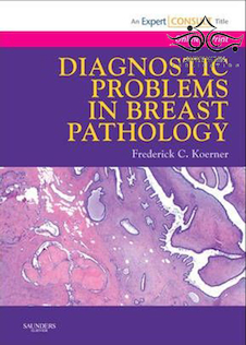 عکس Diagnostic Problems in Breast Pathology 1st Edition2008 مشکلات تشخیصی در آسیب شناسی پستان