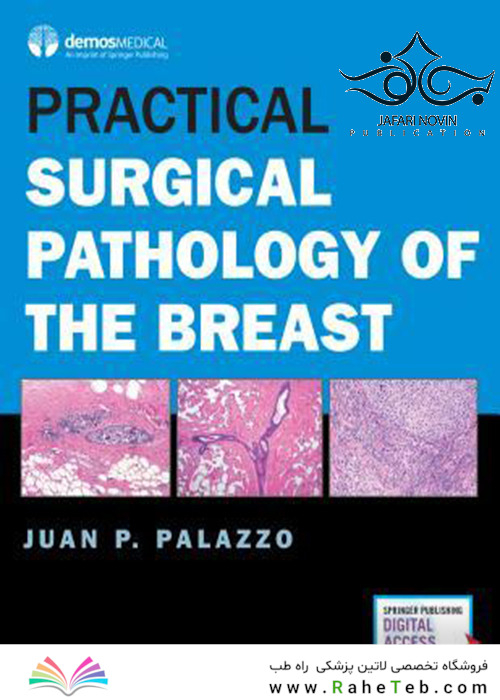 Practical Surgical Pathology of the Breast2018