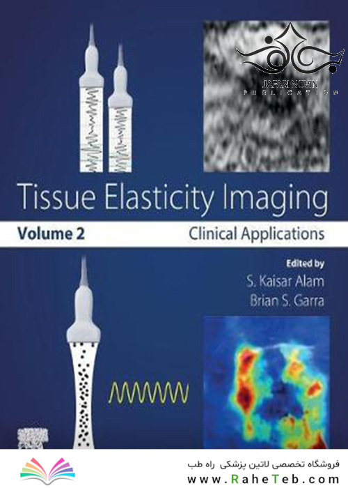 Tissue Elasticity Imaging: Volume 22019 تصویربرداری کشش بافت: جلد 2
