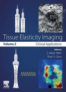 عکس Tissue Elasticity Imaging: Volume 22019 تصویربرداری کشش بافت: جلد 2