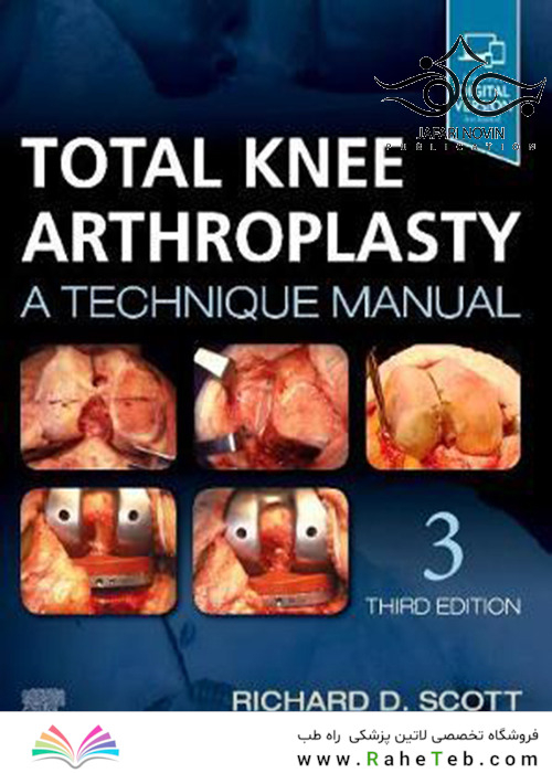 Total Knee Arthroplasty 3rd Edition2019 آرتروپلاستی کامل زانو