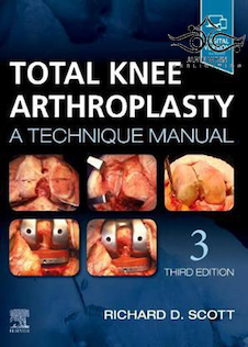 عکس Total Knee Arthroplasty 3rd Edition2019 آرتروپلاستی کامل زانو
