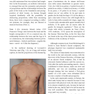 Plastic and Cosmetic Surgery of the Male Breast2021 جراحی پلاستیک و زیبایی پستان نر