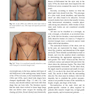 Plastic and Cosmetic Surgery of the Male Breast2021 جراحی پلاستیک و زیبایی پستان نر