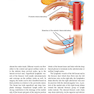 Plastic and Cosmetic Surgery of the Male Breast2021 جراحی پلاستیک و زیبایی پستان نر