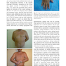 Plastic and Cosmetic Surgery of the Male Breast2021 جراحی پلاستیک و زیبایی پستان نر