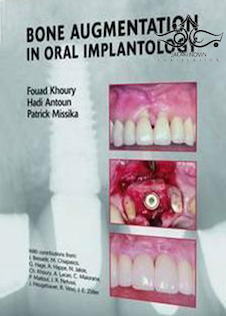 عکس Bone Augmentation in Oral Implantology2007 افزایش استخوان در ایمپلنتولوژی دهان