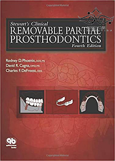 عکس Stewart’s Clinical Removable Partial Prosthodontics 4th Edition2008 پروتزهای متحرک بالینی