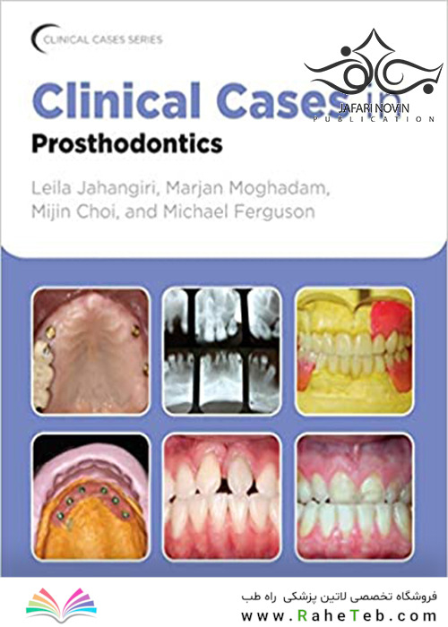 Clinical Cases in Prosthodontics 1st Edition2010 موارد بالینی در پروتزهای دندانی
