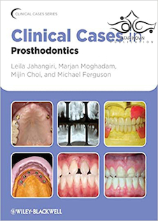عکس Clinical Cases in Prosthodontics 1st Edition2010 موارد بالینی در پروتزهای دندانی