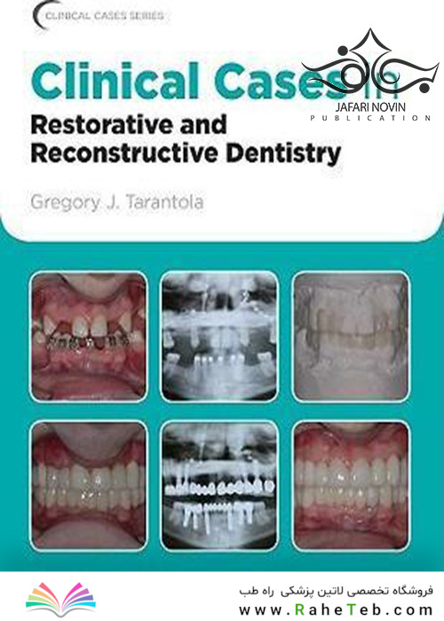 Clinical Cases in Restorative and Reconstructive Dentistry2010 موارد بالینی در دندانپزشکی ترمیمی