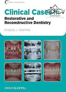 عکس Clinical Cases in Restorative and Reconstructive Dentistry2010 موارد بالینی در دندانپزشکی ترمیمی