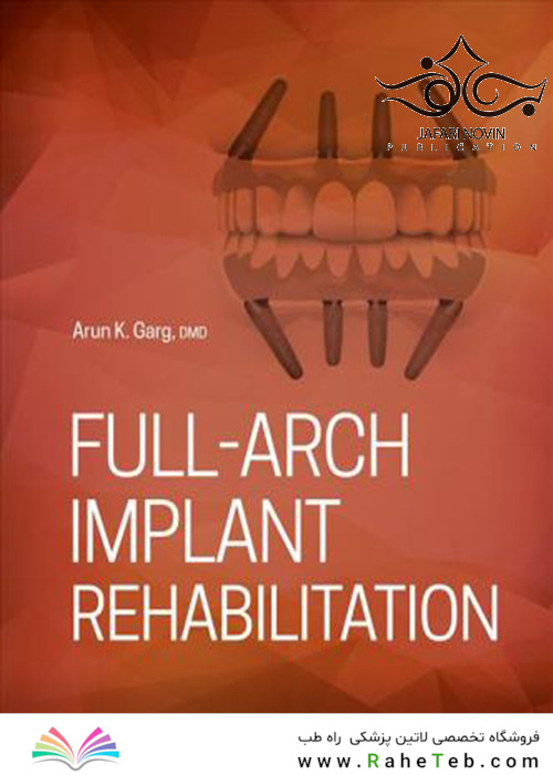 Full-Arch Implant Rehabilitation 1st Edition2019 توان بخشی کامل کاشت