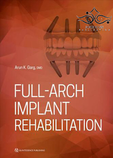 عکس Full-Arch Implant Rehabilitation 1st Edition2019 توان بخشی کامل کاشت