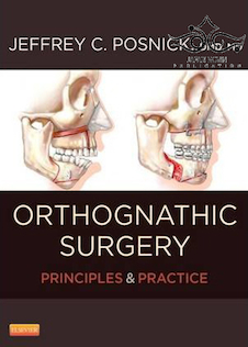 عکس Orthognathic Surgery – 2 Volume Set: Principles and Practice2013 اصول و عمل جراحی ارتوگناتیک