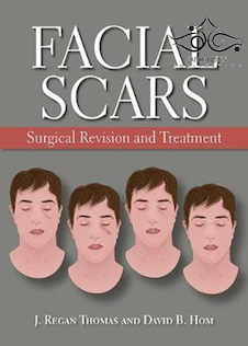 عکس Facial Scars: Surgical Revision and Treatment2017