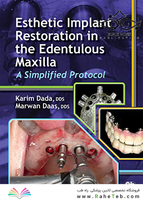 Esthetic Implant Restoration in the Edentulous Maxilla2014 ترمیم ایمپلنت زیبایی در فک بالا