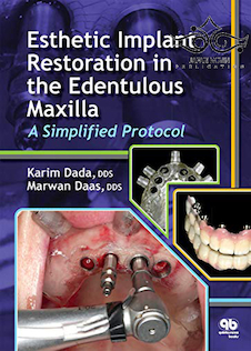 عکس Esthetic Implant Restoration in the Edentulous Maxilla2014 ترمیم ایمپلنت زیبایی در فک بالا