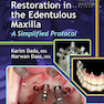 Esthetic Implant Restoration in the Edentulous Maxilla2014 ترمیم ایمپلنت زیبایی در فک بالا
