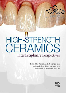 عکس High-Strength Ceramics 1st Edition2014 سرامیک ها با مقاومت بالا