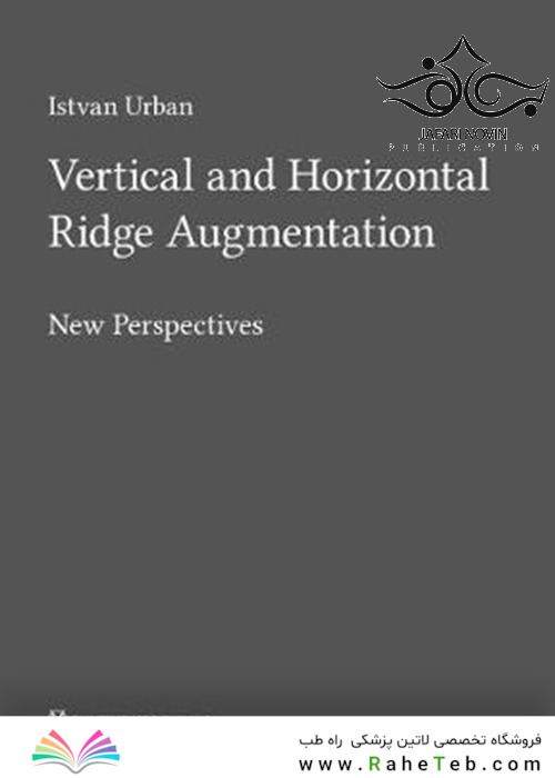 Vertical and Horizontal Ridge Augmentation