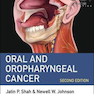 Oral and Oropharyngeal Cancer 2nd Edition2018 سرطان دهان و حلق