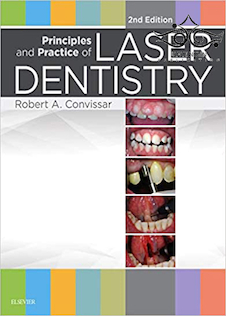 عکس Principles and Practice of Laser Dentistry 2nd Edition2015 اصول و عملکرد دندانپزشکی لیزر