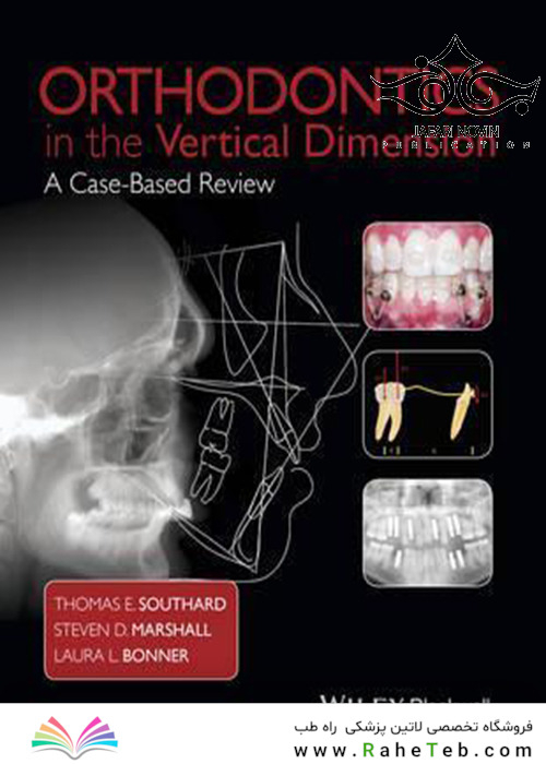 Orthodontics in the Vertical Dimension