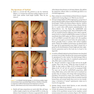 Orthodontics in the Vertical Dimension