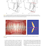 Orthodontics in the Vertical Dimension