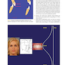 Orthodontics in the Vertical Dimension