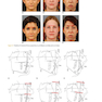 Orthodontics in the Vertical Dimension