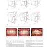 Orthodontics in the Vertical Dimension