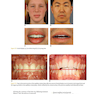 Orthodontics in the Vertical Dimension