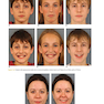 Orthodontics in the Vertical Dimension