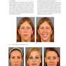 Orthodontics in the Vertical Dimension