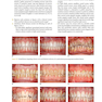 Orthodontics in the Vertical Dimension