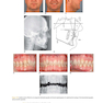Orthodontics in the Vertical Dimension