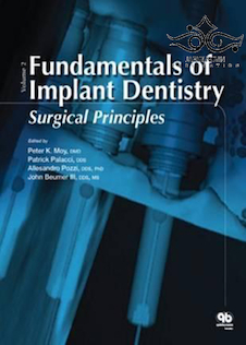 عکس Fundamentals of Implant Dentistry 1st Edition2016 مبانی دندانپزشکی ایمپلنت