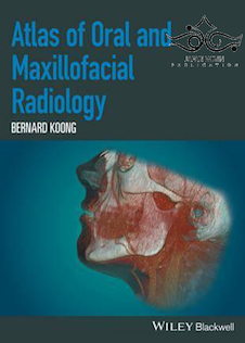 عکس Atlas of Oral and Maxillofacial Radiology 1st Edition2017 اطلس رادیولوژی دهان و فک و صورت